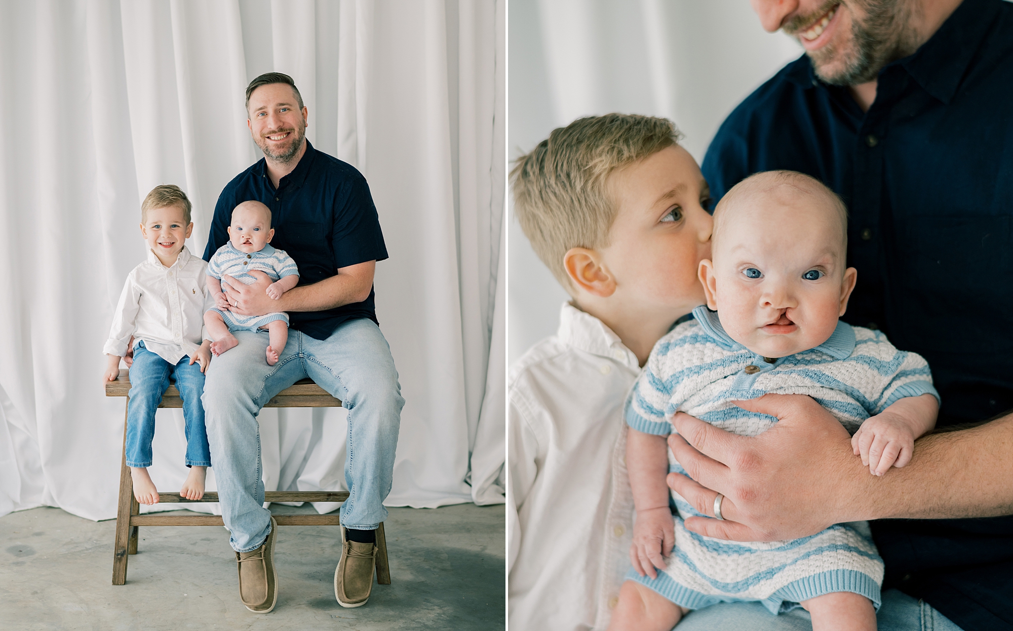 dad holds baby boy with cleft palate on his knee while big brother gives the baby a kiss